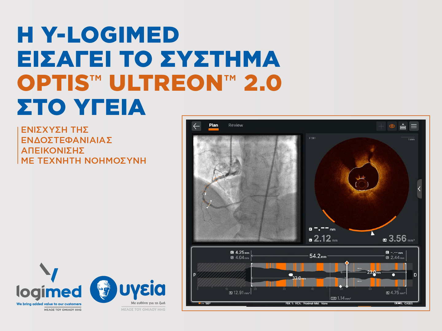 Η Y-Logimed εισάγει το σύστημα OPTIS™ ULTREON™ 2.0 στο ΥΓΕΙΑ – Ενίσχυση της ενδοστεφανιαίας απεικόνισης με Τεχνητή Νοημοσύνη